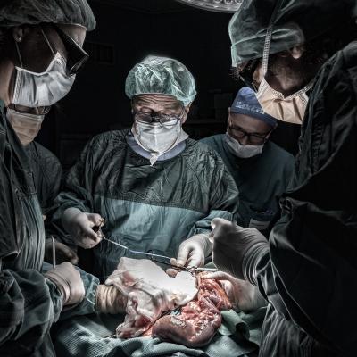 B Di Candia Lorenzo Manfredonia B1 Laparoscopic Oncological Surgery