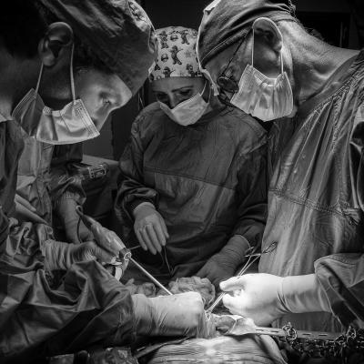 A Di Candia Lorenzo Manfredonia Fg A3 Epatic Surgery